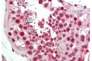 Immunohistochemistry (IHC) image for anti-Chromobox Homolog 3 (CBX3) (Middle Region) antibody (ABIN2775975)