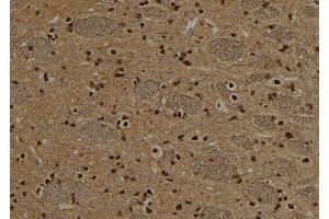 ABIN6272947 at 1/100 staining Rat brain tissue by IHC-P. (NSUN2 抗体  (Internal Region))