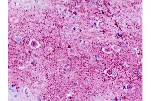 Human, Brain, Cortex: Formalin-Fixed Paraffin-Embedded (FFPE) (GPR173 抗体  (C-Term))