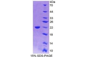 SDS-PAGE (SDS) image for Interleukin 18 (IL18) ELISA Kit (ABIN6720553)