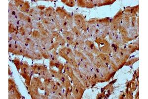 IHC image of ABIN7160664 diluted at 1:300 and staining in paraffin-embedded human heart tissue performed on a Leica BondTM system. (MYOZ2 抗体  (AA 90-180))