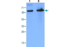 Western blot analysis of cell lysates (each 40 ug) by PDZK1 monoclonal antibody, clone AT1A2  (1:1000). (PDZK1 抗体  (AA 1-519))