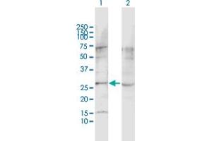 Western Blot analysis of LPHN1 expression in transfected 293T cell line by LPHN1 MaxPab polyclonal antibody. (Latrophilin 1 抗体  (AA 1-201))