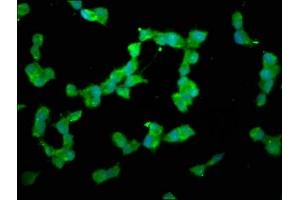 Immunofluorescence staining of SH-SY5Y cells with ABIN7150765 at 1:200, counter-stained with DAPI. (DUSP26 抗体  (AA 1-211))