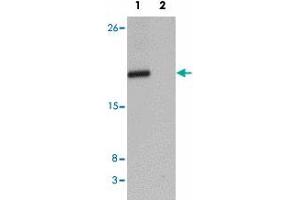Western blot analysis of CXXC4 in human brain tissue lysate with CXXC4 polyclonal antibody  at 1 ug/mL in (1) the absence and (2) the presence of blocking peptide. (CXXC4 抗体  (N-Term))