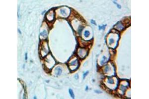 Immunohistochemistry (IHC) image for anti-Cadherin 1, Type 1, E-Cadherin (Epithelial) (CDH1) (AA 153-264) antibody (ABIN1077885)
