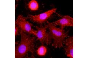 Immunofluorescence of human HeLa cells stained with monoclonal anti-human MINCLE antibody (1:500) with Texas Red (Red).