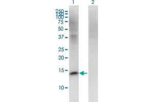Western Blot analysis of FMN2 expression in transfected 293T cell line by FMN2 monoclonal antibody (M06), clone 1C2. (Formin 2 抗体  (AA 144-243))