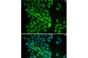 Immunofluorescence analysis of A-549 cells using YTHDC1 Polyclonal Antibody (YTHDC1 抗体)