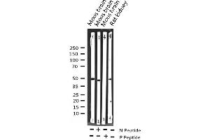 Western blot analysis of Phospho-SRF (Ser99) expression in various lysates (SRF 抗体  (pSer99))