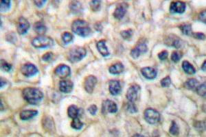 Image no. 1 for anti-Junction Plakoglobin (JUP) antibody (ABIN265337) (JUP 抗体)