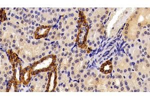 Immunohistochemistry (IHC) image for anti-Keratin 19 (KRT19) (AA 245-391) antibody (ABIN7433303)