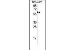 Image no. 1 for anti-Runt-Related Transcription Factor 2 (RUNX2) (Ser6533) antibody (ABIN360019) (RUNX2 抗体  (Ser6533))