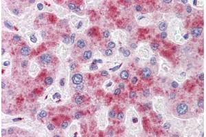 Human Liver: Formalin-Fixed, Paraffin-Embedded (FFPE) (ATG16L1 抗体  (AA 38-87))