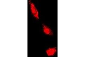 Immunofluorescent analysis of PKC iota/zeta staining in HeLa cells. (PKC iota/zeta 抗体)