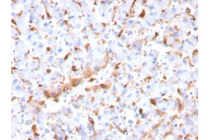 Immunohistochemistry (IHC) image for anti-Complement Component 1, Q Subcomponent, B Chain (C1QB) (AA 41-188) antibody (ABIN6940772)