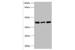 Western blot All lanes: Alpha-2, 8-sialyltransferase 8B antibody at 8 μg/mL Lane 1: Mouse heart tissue Lane 2: HepG2 whole cell lysate Lane 3: Mouse kidney tissue Secondary Goat polyclonal to rabbit IgG at 1/10000 dilution Predicted band size: 42 kDa Observed band size: 42 kDa (ST8SIA2 抗体  (AA 24-160))