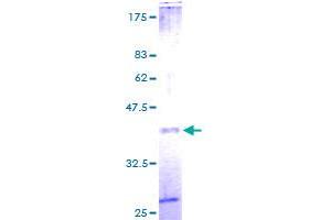 Image no. 1 for beta-2-Microglobulin (B2M) (AA 1-119) protein (GST tag) (ABIN1346265) (beta-2 Microglobulin Protein (AA 1-119) (GST tag))