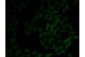 Immunofluorescence analysis of HeLa cell using MSN antibody. (Moesin 抗体)
