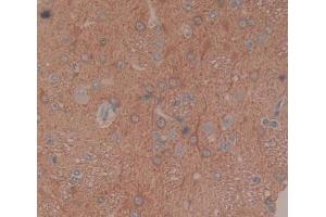 Used in DAB staining on fromalin fixed paraffin- embedded brain tissue (BCAT1 抗体  (AA 179-411))