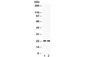 Western blot testing of 1) rat spleen and 2) rat lung lysate with Lipocalin 2 antibody. (Lipocalin 2 抗体  (AA 21-200))
