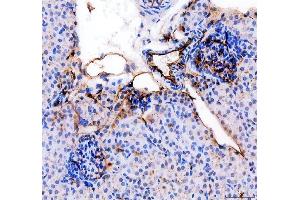 IHC analysis of CD31/Pecam1 using anti-CD31/Pecam1 antibody (ABIN7601662). (CD31 抗体  (AA 41-258))