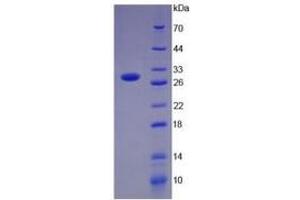 SDS-PAGE of Protein Standard from the Kit (Highly purified E. (PD-L1 ELISA 试剂盒)