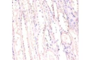 Immunohistochemistry of paraffin-embedded human kidney tissue using ABIN7168366 at dilution of 1:100 (FUS 抗体  (AA 1-198))