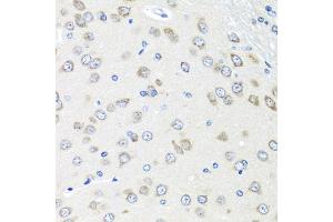 Immunohistochemistry of paraffin-embedded rat brain using PI antibody (ABIN6128452, ABIN6145599, ABIN6145601 and ABIN6222851) at dilution of 1:100 (40x lens). (PIAS3 抗体  (AA 452-628))