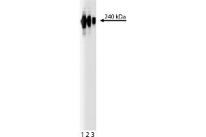 Western Blotting (WB) image for anti-Fibronectin antibody (ABIN967729) (Fibronectin 抗体)