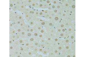 Immunohistochemistry (Paraffin-embedded Sections) (IHC (p)) image for anti-Scaffold Attachment Factor B (SAFB) antibody (ABIN7263975)