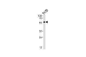 Western Blotting (WB) image for anti-Cytochrome P450, Family 27, Subfamily B, Polypeptide 1 (CYP27B1) antibody (ABIN2897847) (CYP27B1 抗体)