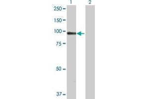 Western Blot analysis of ACTN1 expression in transfected 293T cell line by ACTN1 MaxPab polyclonal antibody. (ACTN1 抗体  (AA 1-892))