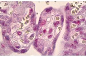 Anti-MSK1 antibody IHC staining of human placenta. (MSK1 抗体)