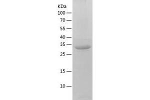 Western Blotting (WB) image for Selectin P Ligand (SELPLG) (AA 18-320) protein (His tag) (ABIN7125013)