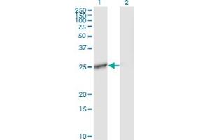 Western Blot analysis of IL27 expression in transfected 293T cell line by IL27 monoclonal antibody (M01), clone 3F12. (IL-27 抗体  (AA 177-243))
