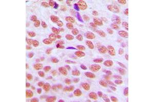 Immunohistochemistry (IHC) image for anti-Chromobox Homolog 5 (CBX5) (Center) antibody (ABIN7297972)