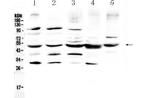 Western blot analysis of Bag5 using anti- Bag5 antibody . (BAG5 抗体  (AA 389-447))