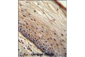 WIBG antibody (N-term) (ABIN654666 and ABIN2844362) immunohistochemistry analysis in formalin fixed and paraffin embedded human cervical tissue followed by peroxidase conjugation of the secondary antibody and DAB staining. (PYM 抗体  (N-Term))