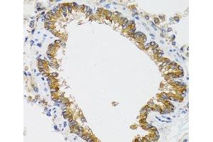 Immunohistochemistry of paraffin-embedded Rat lung using CHMP4B Polyclonal Antibody at dilution of 1:100 (40x lens). (CHMP4B 抗体)