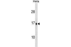 UBE2D3 Antibody (C-term) western blot analysis in Hela cell line lysates (35 µg/lane). (UBE2D3 抗体  (C-Term))