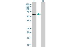Western Blot analysis of SOX30 expression in transfected 293T cell line by SOX30 MaxPab polyclonal antibody. (SOX30 抗体  (AA 1-501))