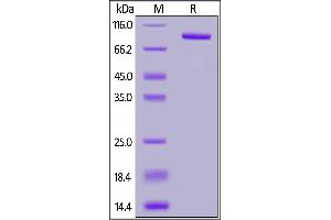 SDS-PAGE (SDS) image for Fibroblast Activation Protein, alpha (FAP) (AA 26-760) (Active) protein (His tag) (ABIN7013467)
