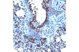 Immunohistochemistry of paraffin-embedded rat lung using MUC1 Rabbit pAb (ABIN6131522, ABIN6144194, ABIN6144195 and ABIN6213810) at dilution of 1:100 (40x lens). (MUC1 抗体  (AA 1182-1255))