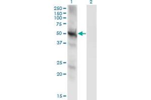 Western Blot analysis of PPP3CC expression in transfected 293T cell line by PPP3CC monoclonal antibody (M01), clone 4D1. (PPP3CC 抗体  (AA 1-81))