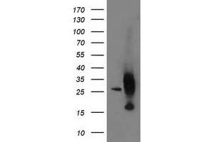 Western Blotting (WB) image for anti-Adenylate Kinase 4 (AK4) antibody (ABIN1496530) (AK4 抗体)