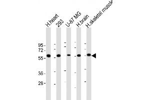 Western Blot at 1:1000 dilution Lane 1: human heart lysate Lane 2: 293 whole cell lysate Lane 3: U-87 MG whole cell lysate Lane 4: human brain lysate Lane 5: human skeletal muscle lysate Lysates/proteins at 20 ug per lane.