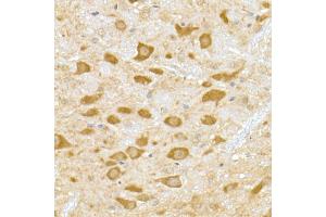 Immunohistochemistry of paraffin-embedded mouse brain using DENN Rabbit mAb (ABIN7268396) at dilution of 1:50 (40x lens). (MADD 抗体)