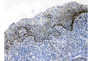 Immunohistochemistry (IHC) image for anti-Activated Leukocyte Cell Adhesion Molecule (ALCAM) (AA 167-406) antibody (ABIN5518801)