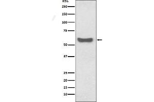 anti-Immunoglobulin Heavy Constant alpha 1 (IGHA1) antibody